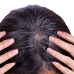 Tìm hiểu về hiện tượng tóc bạc sớm